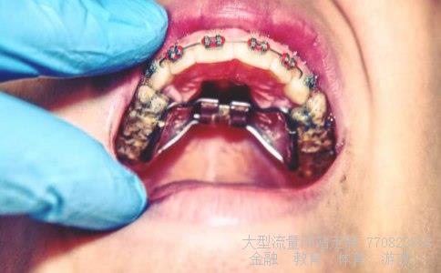 海南黄花梨木价格-请问海南黄花梨木价格花梨木与黄花梨的区别有哪些